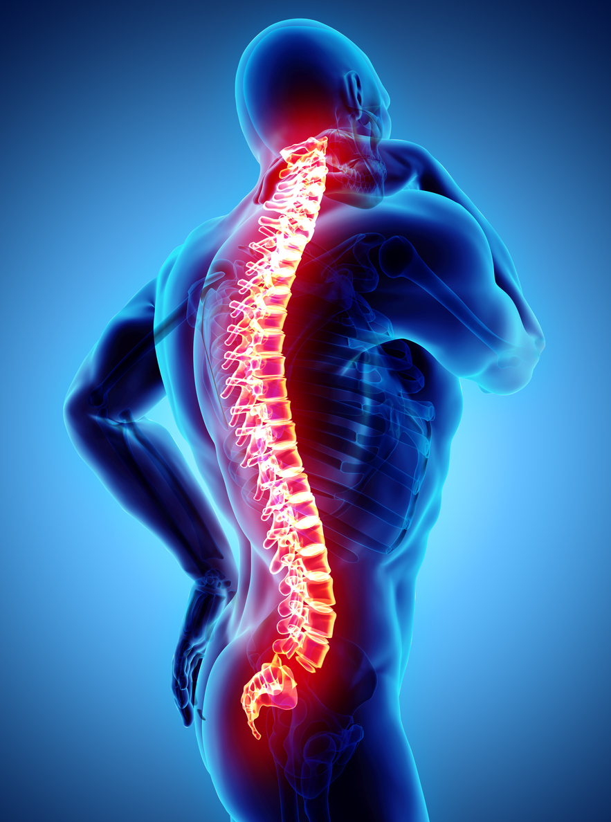 Six Signs of Spinal Stenosis